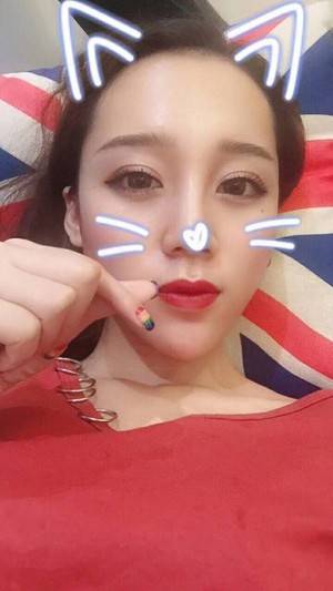 雅美整形 宋宋